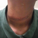 Image for article titled Family Alleges Students at a Texas School Wrapped a Rope Around Their Daughter's Neck